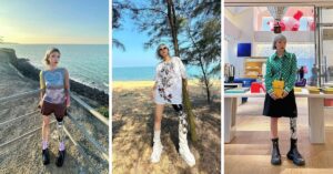 Model and creator Xiaoyang with Prosthetic Leg Shares Story of Self-Acceptance and Bravery