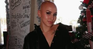 Embracing Uniqueness The Inspiring Journey of Alex Youmazzo